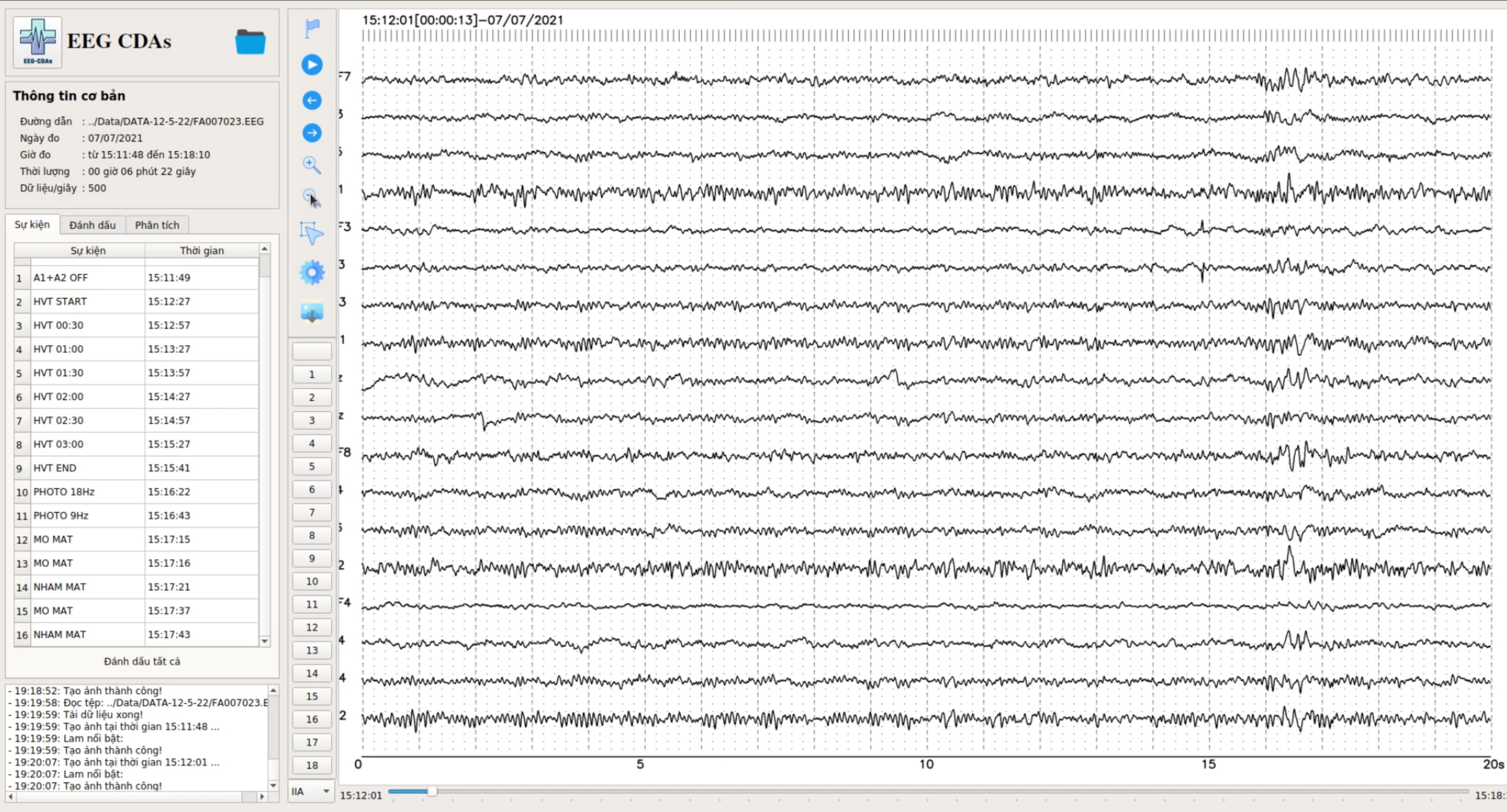 EEG Data Display