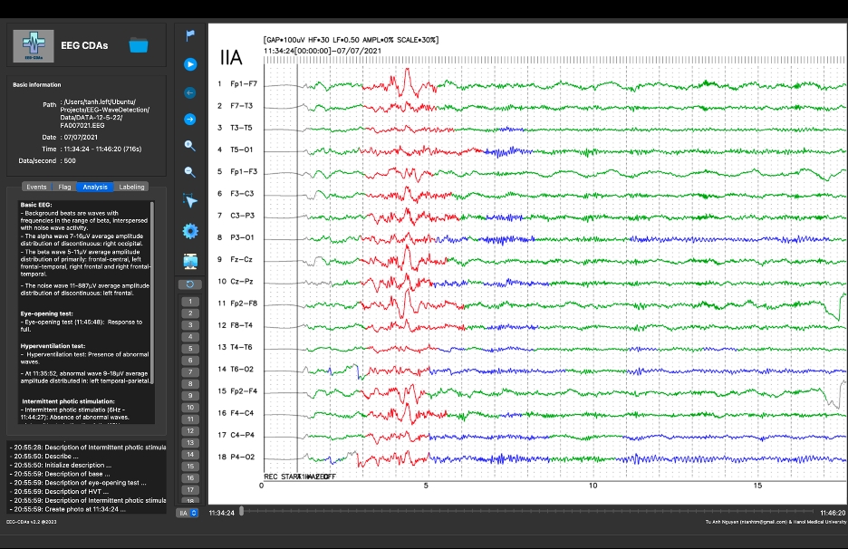 EEG CDAs